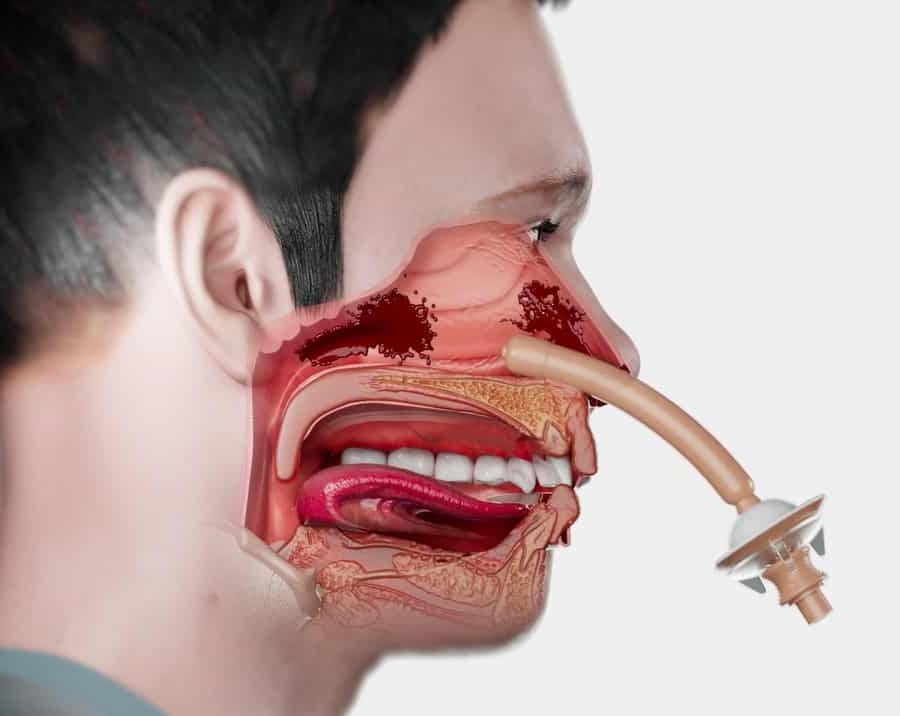 jstop-demo-insertion